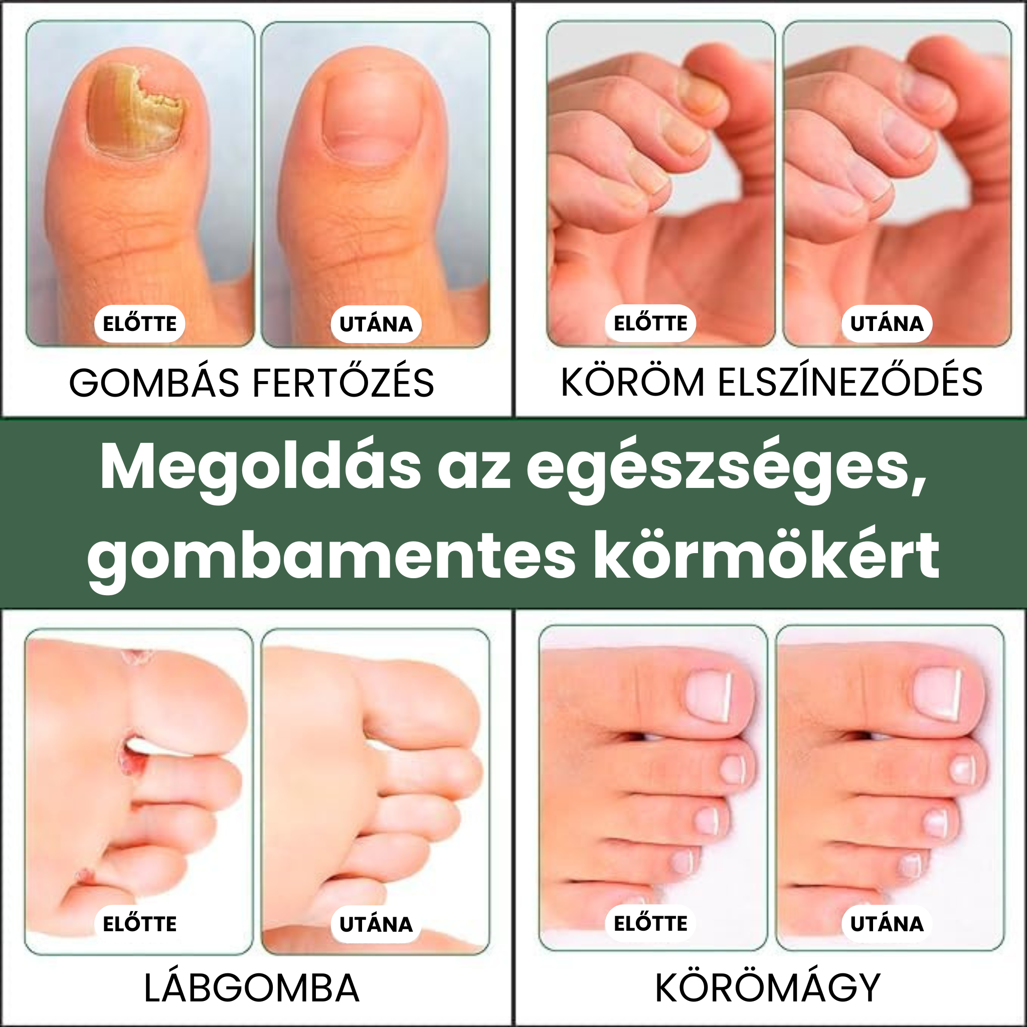 Fungi Hunter körömgomba elleni ecsetelő 50ml 2