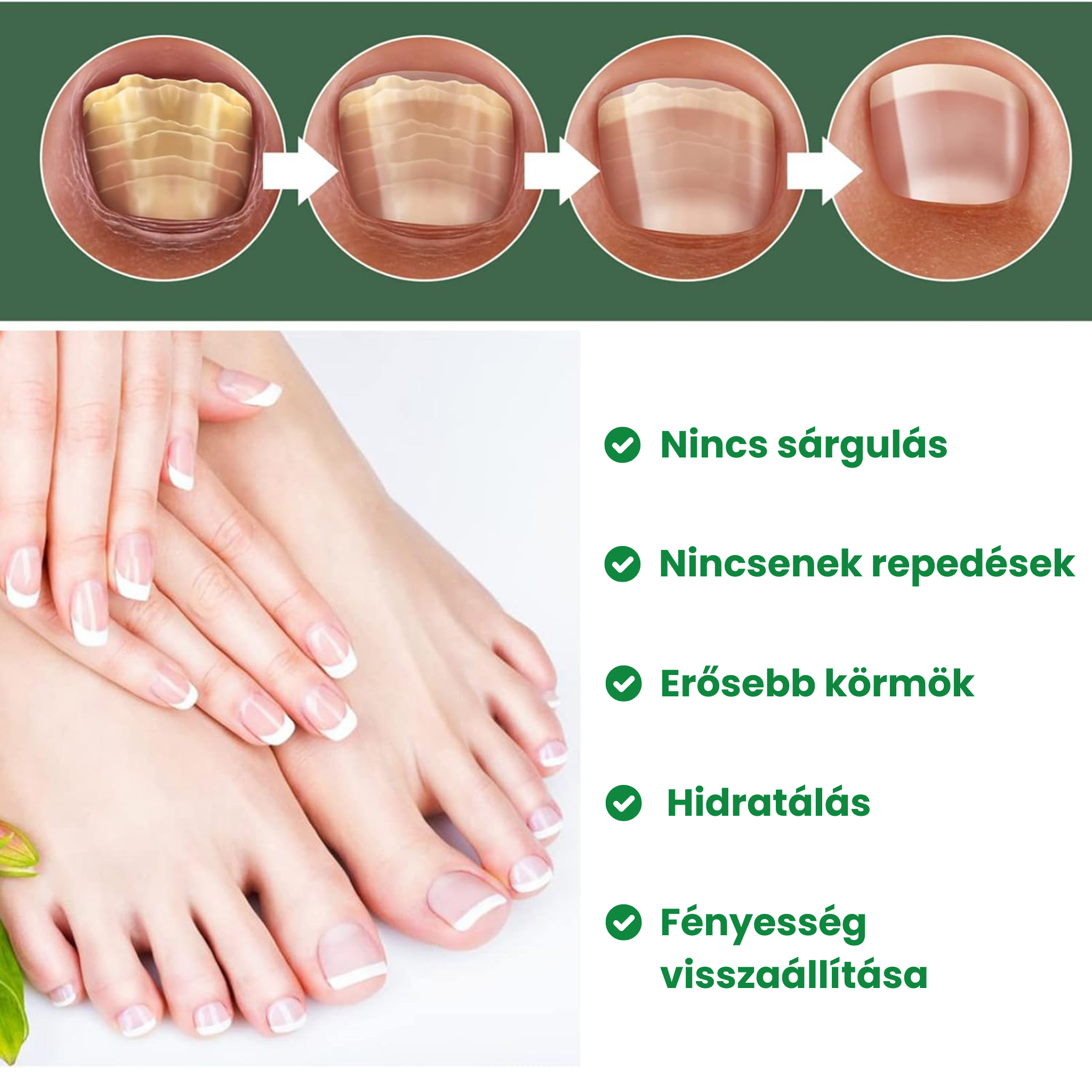 Fungi Hunter körömgomba elleni ecsetelő 50ml 5